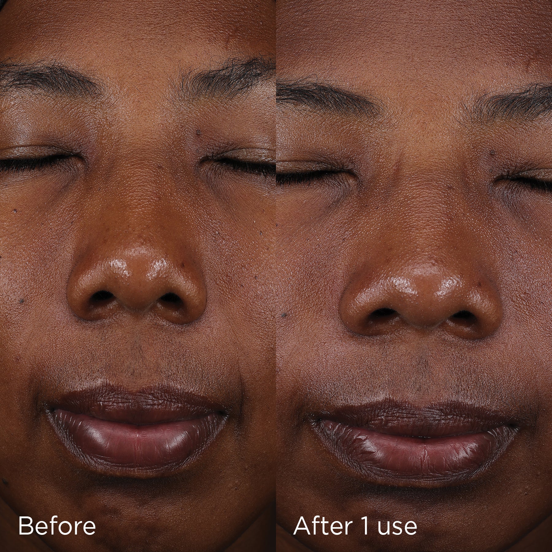 Close-up comparison of skin appearance before and after one use of IMAGE Skincare Daily Prevention Pure Mineral Tinted Moisturizer SPF 30, highlighting improved complexion and hydration.