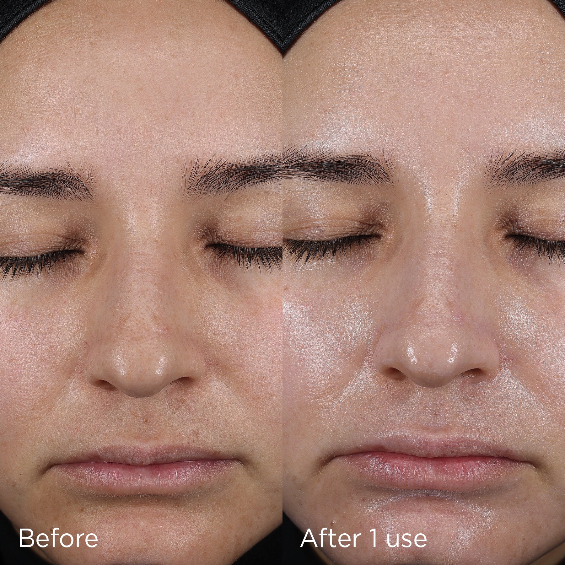 Side-by-side comparison of a woman's face showing "Before" and "After 1 use" results of the Hydrating Moisturizer by Image Skincare.