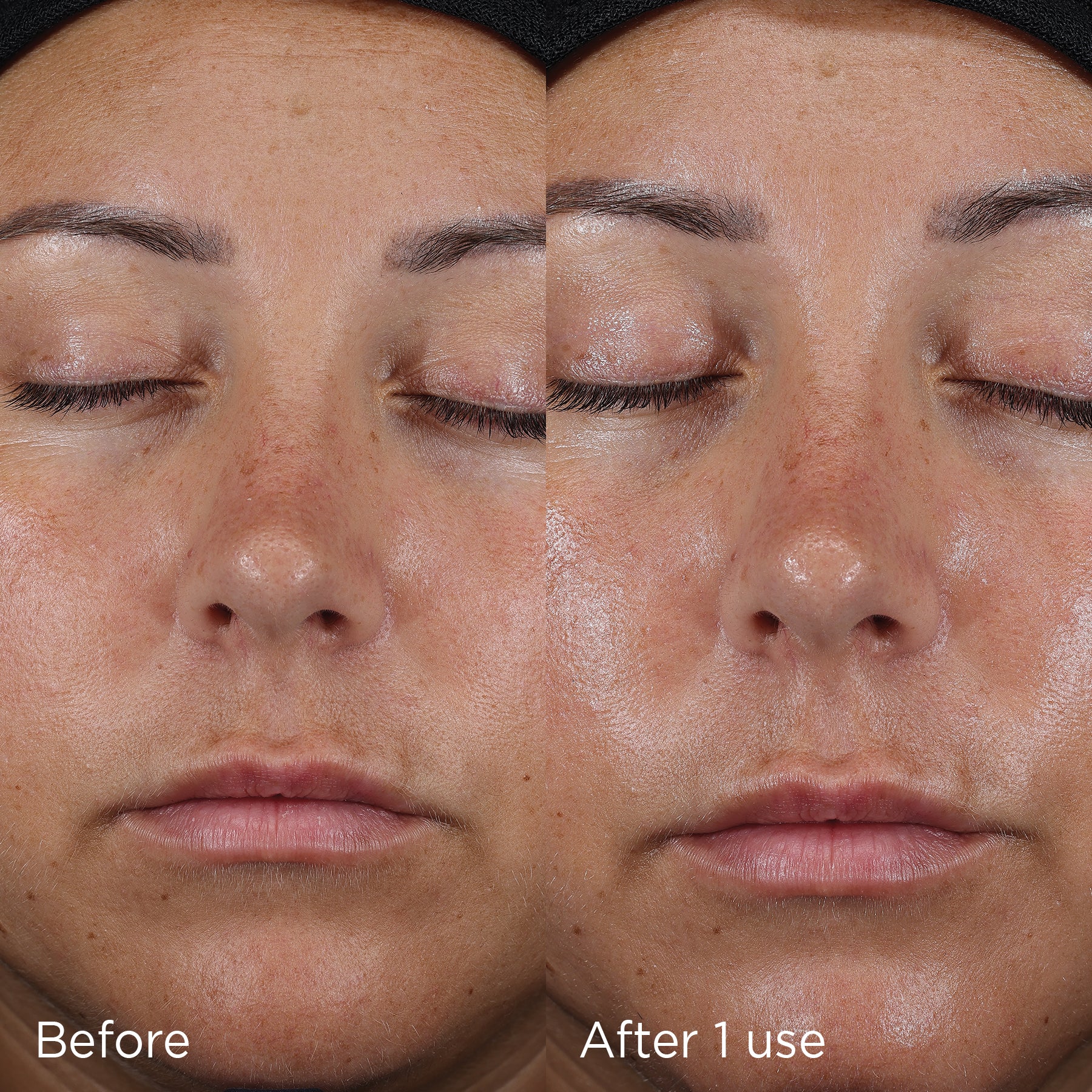 Before and after comparison of using IMAGE Skincare Daily Prevention Ultra Defense Moisturizer with SPF 50, showing improved skin radiance and texture.
