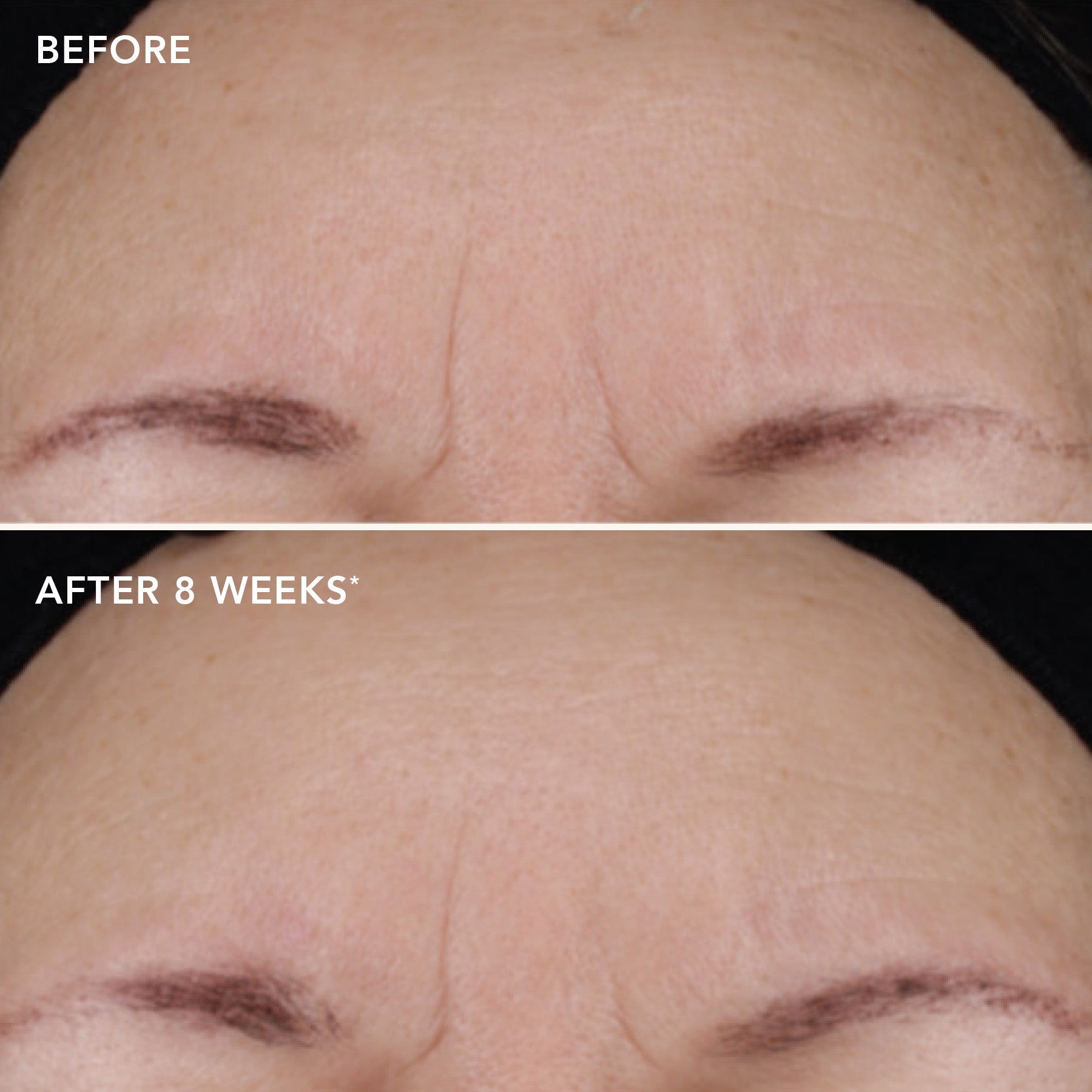 AGELESS+ retinol treatment crème 1.2% retinol complex (travel size)